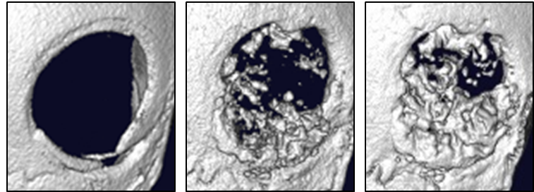 Suivi au microscanner à rayons X de la régénération osseuse dans un défaut comblé avec un hybride à base de bioverre et polycaprolactone (à gauche post-implantation, au milieu après 1 mois, à droite après 3 mois), l’os est en blanc.
